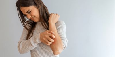 Can You Really Use Tallow for Eczema? - Cowbelle Skincare