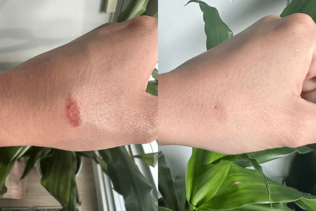 healed my hand burn & now I can barely see the burn mark! - Cowbelle Skincare