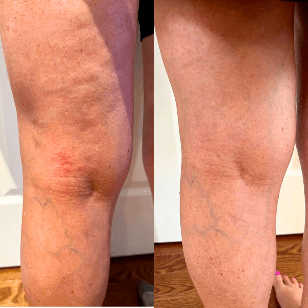 I can’t believe the results! I have suffered from eczema since I was an infant. - Cowbelle Skincare