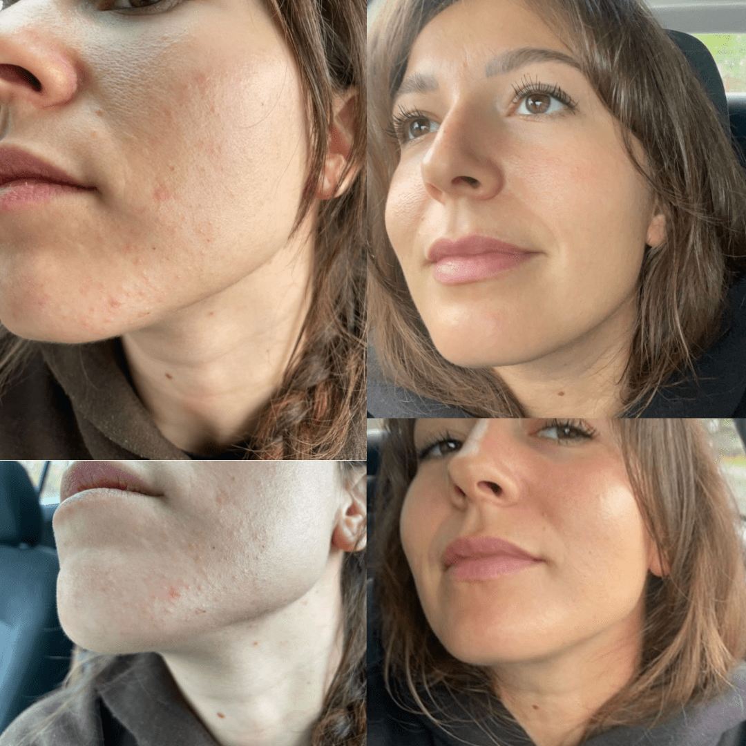 I love how this feels on my skin and it’s helped with all sorts of skin issues - Cowbelle Skincare