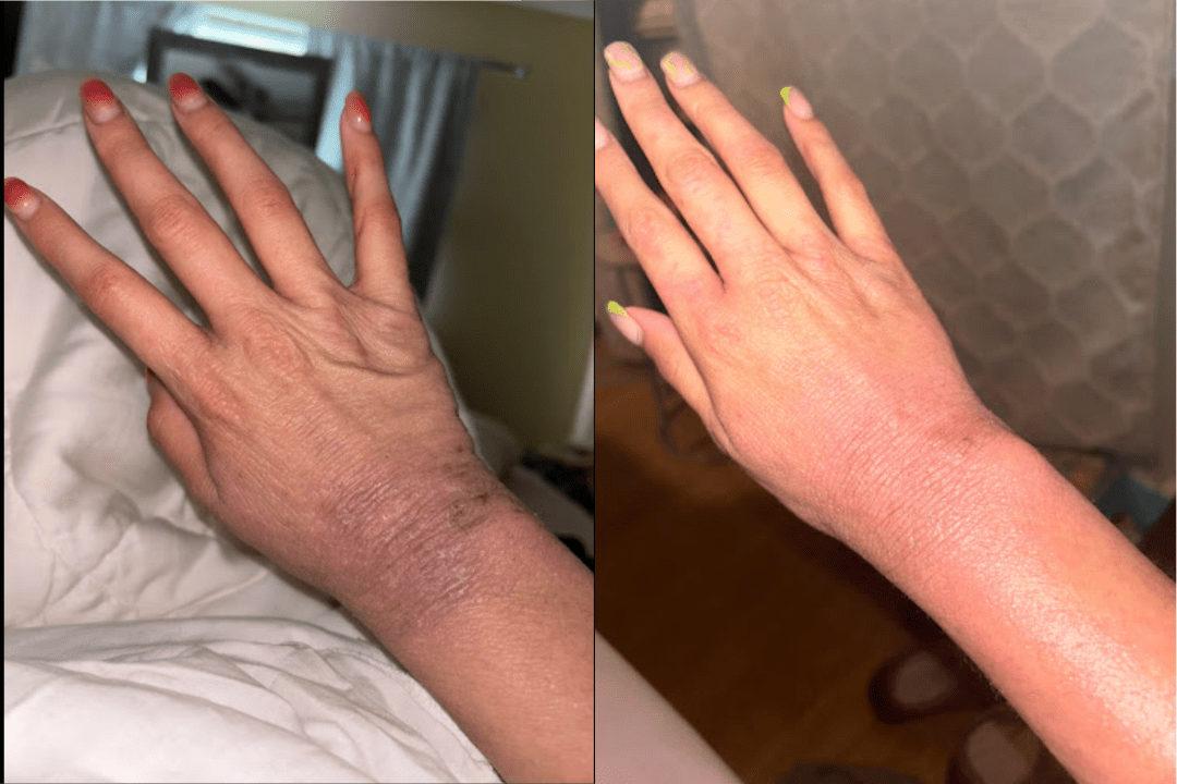 it has worked wonders for my skin and it’s amazing the progress I’ve seen in days... - Cowbelle Skincare