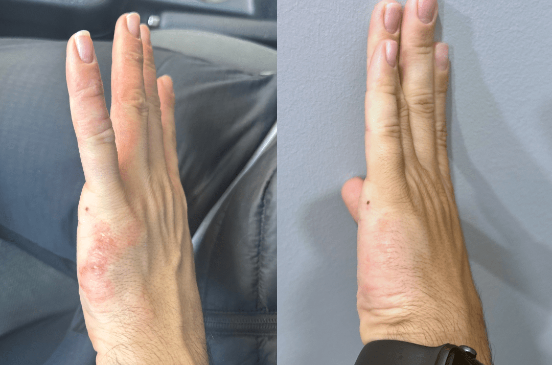 Thanks again for saving my hands and allowing me to work pain free!!!! - Cowbelle Skincare